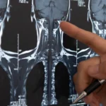 cum-se-efectueaza-o-scanare-ct-cervicala-cu-contrast.webp.webp